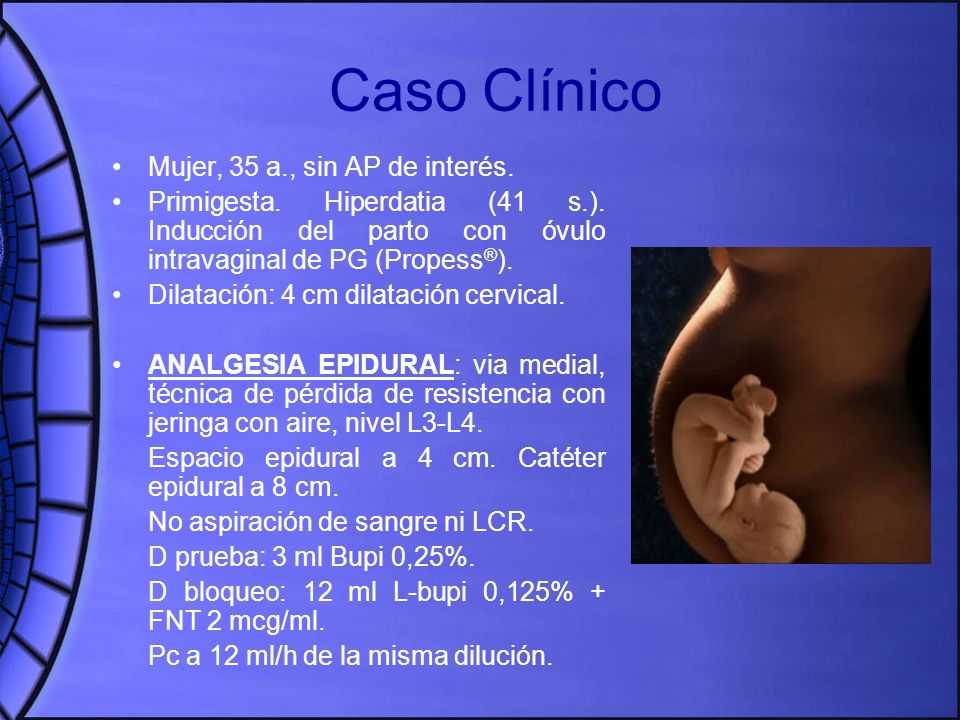 Caso Clínico Mujer, 35 a., sin AP de interés.