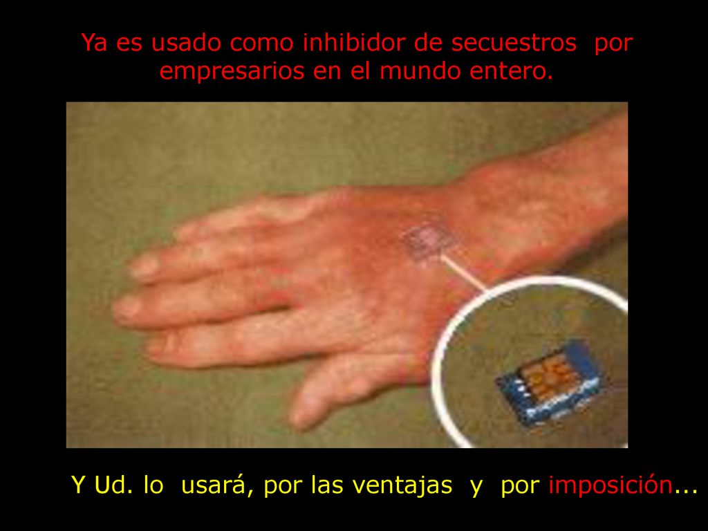 Ya es usado como inhibidor de secuestros por empresarios en el mundo entero.