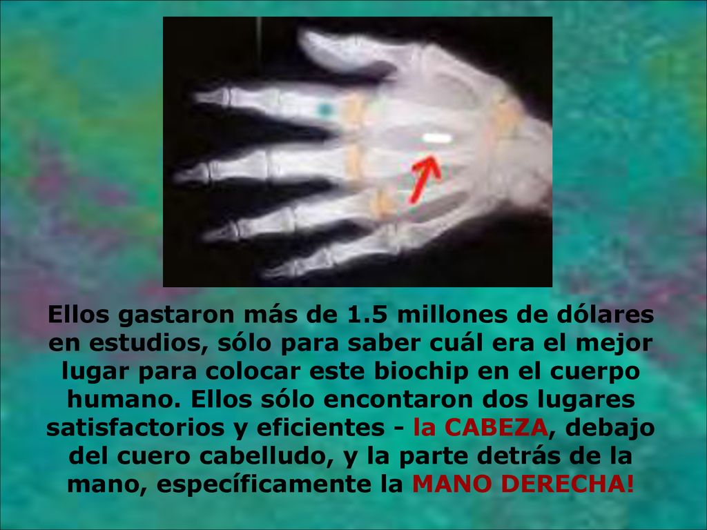 Ellos gastaron más de 1.5 millones de dólares en estudios, sólo para saber cuál era el mejor lugar para colocar este biochip en el cuerpo humano.