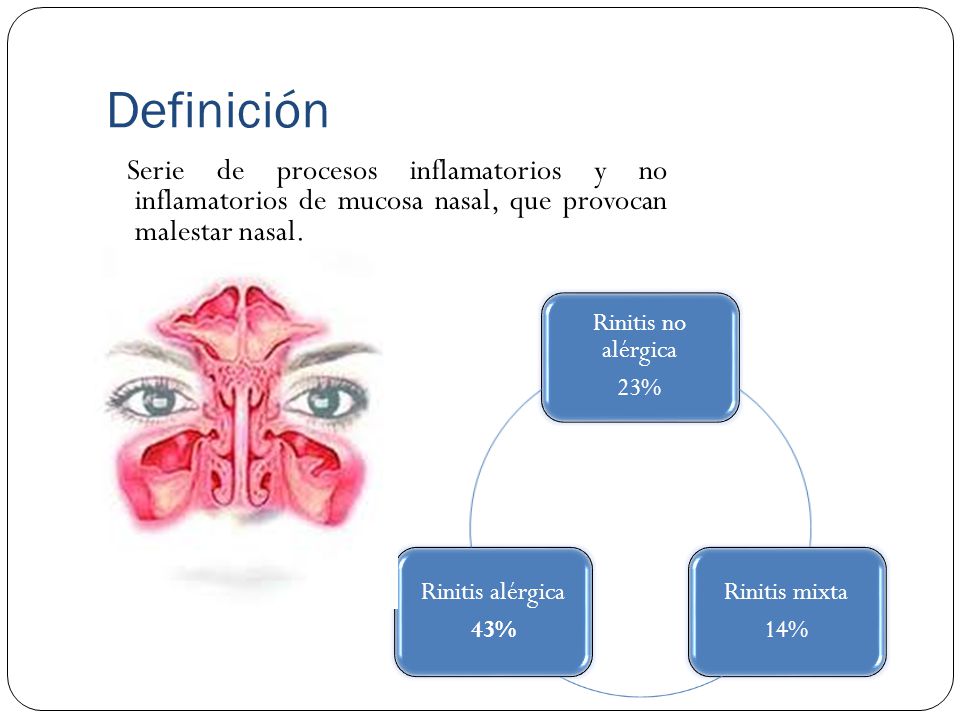 Definición Serie de procesos inflamatorios y no inflamatorios de mucosa nasal, que provocan malestar nasal.