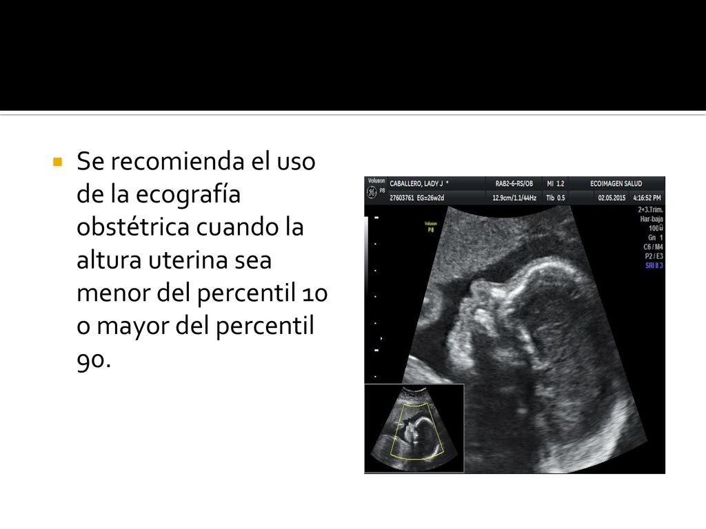 Se recomienda el uso de la ecografía obstétrica cuando la altura uterina sea menor del percentil 10 o mayor del percentil 90.