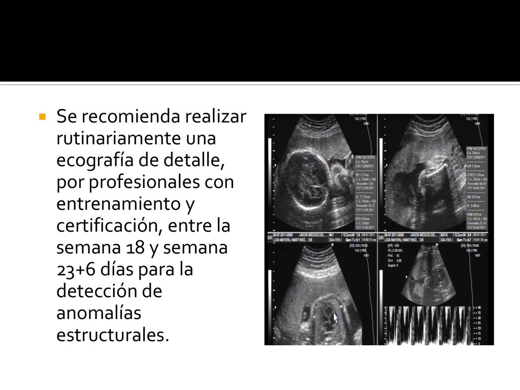 Se recomienda realizar rutinariamente una ecografía de detalle, por profesionales con entrenamiento y certificación, entre la semana 18 y semana 23+6 días para la detección de anomalías estructurales.
