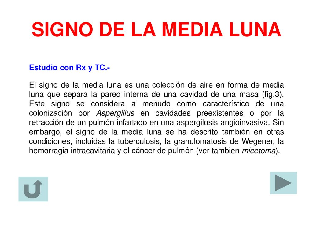 SIGNO DE LA MEDIA LUNA Estudio con Rx y TC.-