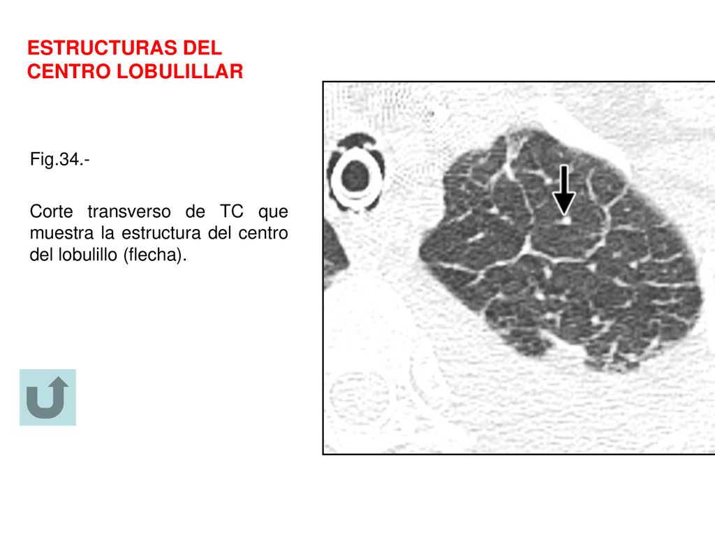 ESTRUCTURAS DEL CENTRO LOBULILLAR