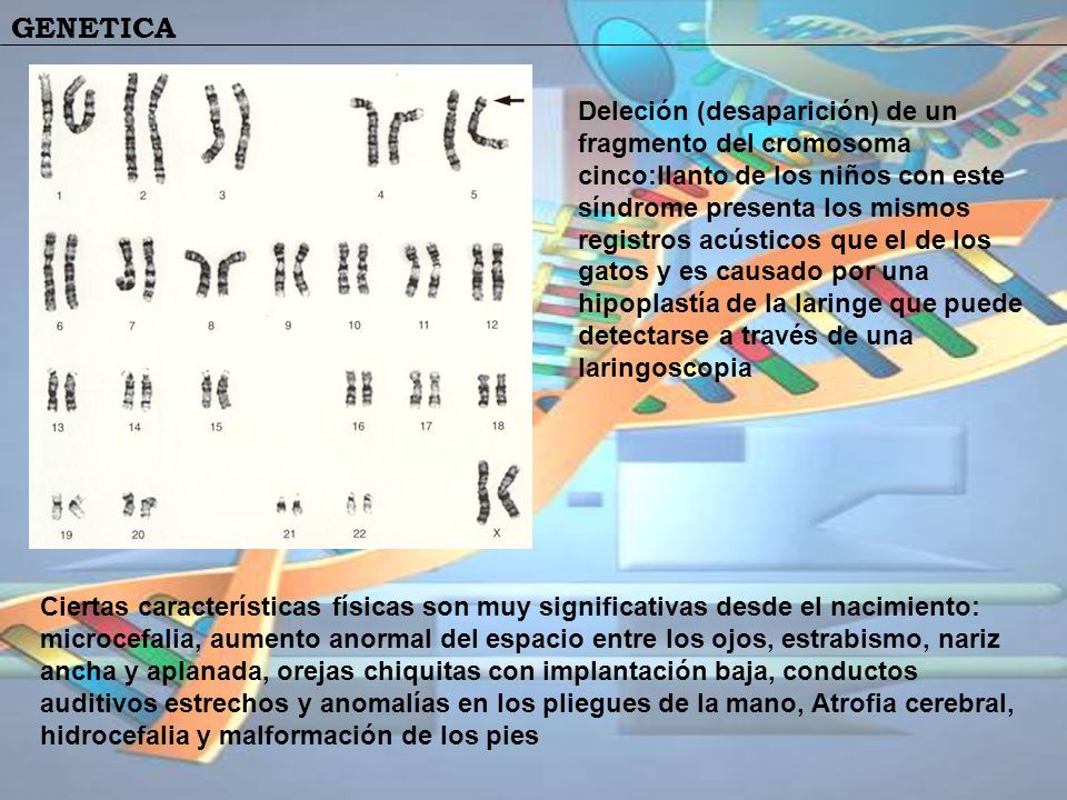 Deleción (desaparición) de un fragmento del cromosoma cinco:llanto de los niños con este síndrome presenta los mismos registros acústicos que el de los gatos y es causado por una hipoplastía de la laringe que puede detectarse a través de una laringoscopia