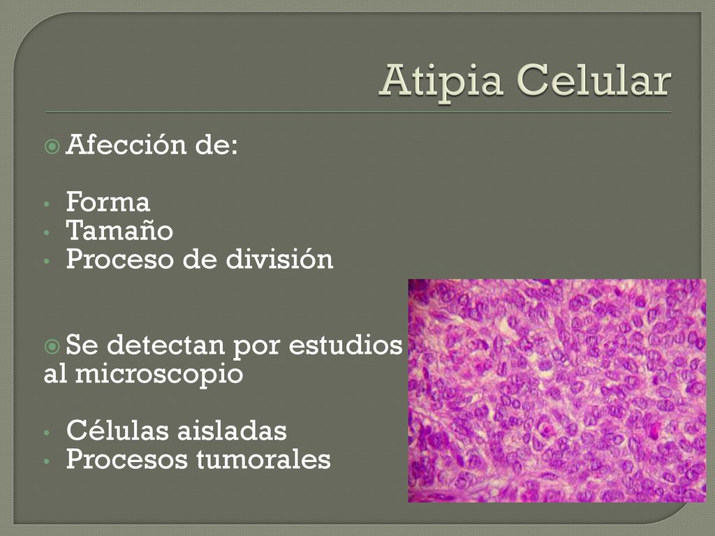 Atipia Celular Afección de: Forma Tamaño Proceso de división