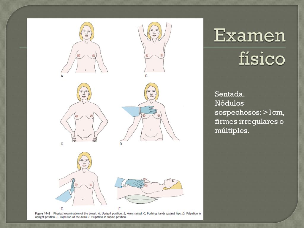 Examen físico Sentada. Nódulos sospechosos: >1cm, firmes irregulares o múltiples.