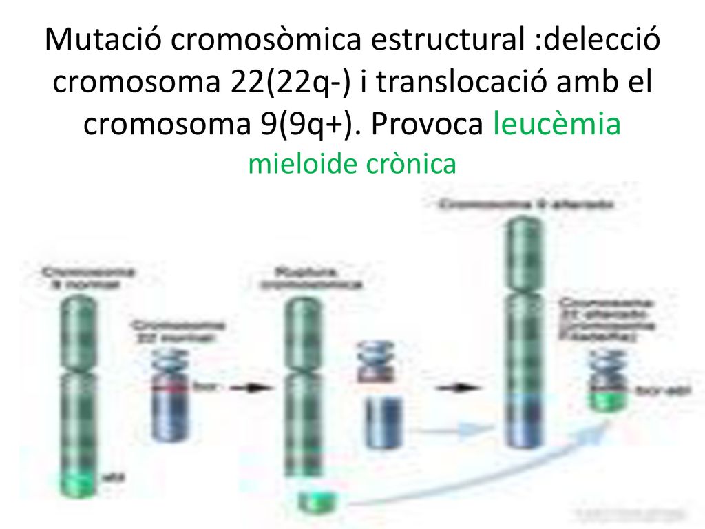 Mutació cromosòmica estructural :delecció cromosoma 22(22q-) i translocació amb el cromosoma 9(9q+).