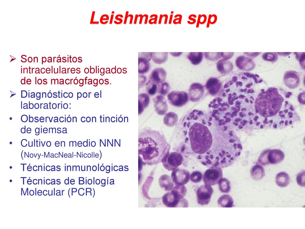 Leishmania spp Son parásitos intracelulares obligados de los macrógfagos. Diagnóstico por el laboratorio: