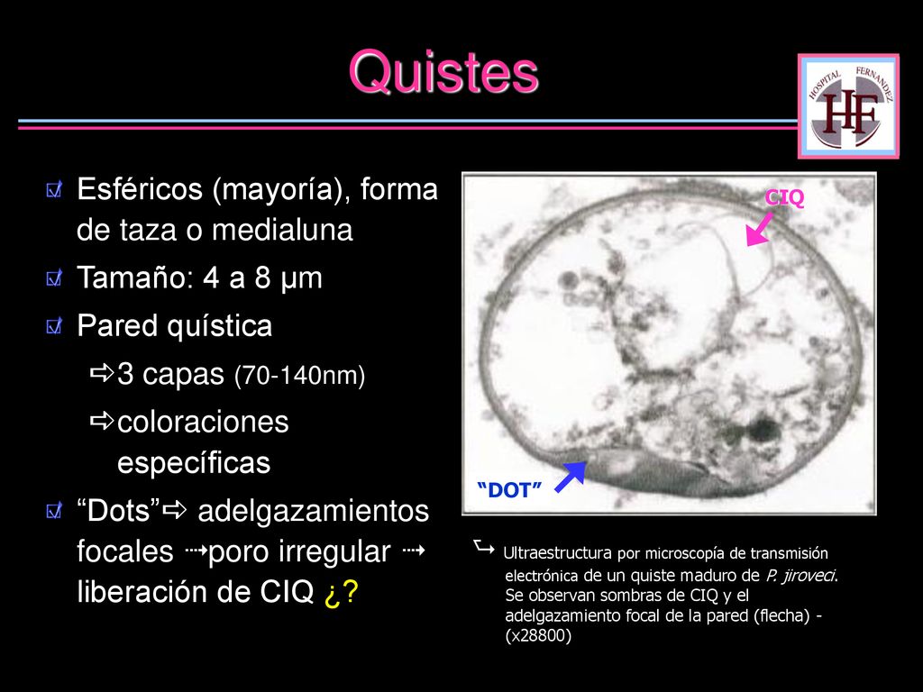 Quistes Esféricos (mayoría), forma de taza o medialuna