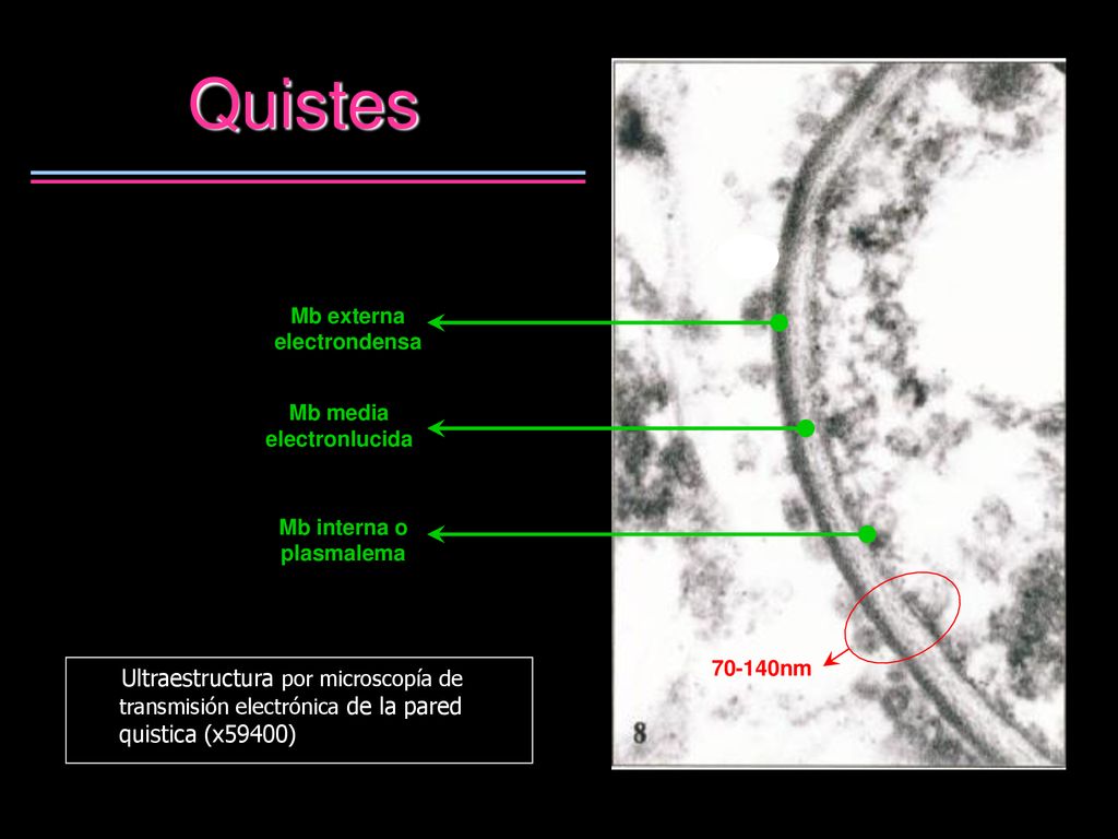 Quistes Mb externa electrondensa. Mb media electronlucida. Mb interna o plasmalema nm.