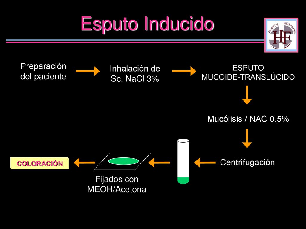 Esputo Inducido Preparación del paciente Inhalación de Sc. NaCl 3%
