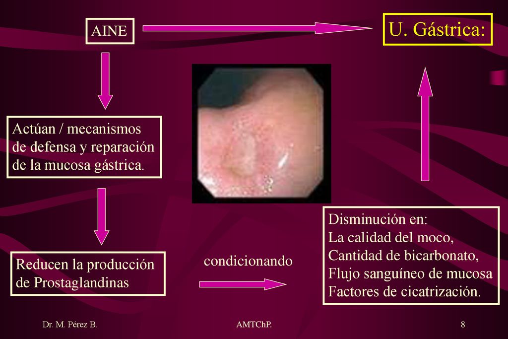 U. Gástrica: AINE Actúan / mecanismos de defensa y reparación
