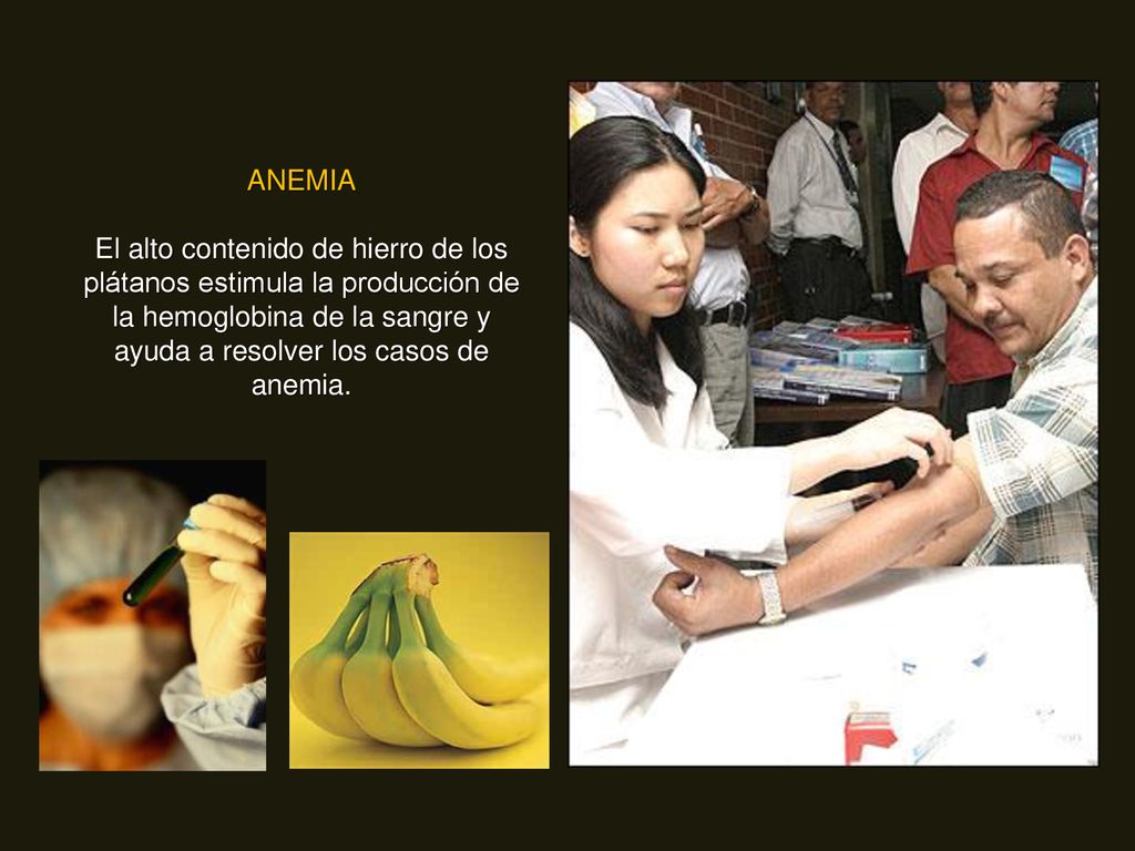 ANEMIA El alto contenido de hierro de los plátanos estimula la producción de la hemoglobina de la sangre y ayuda a resolver los casos de anemia.