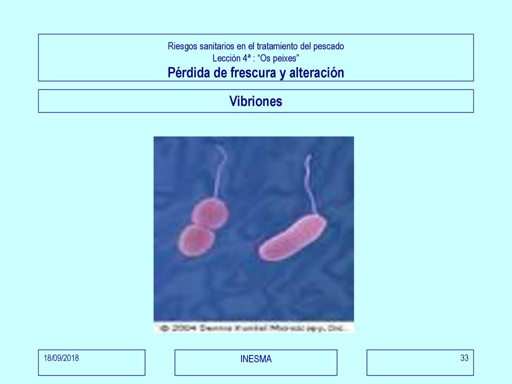 Riesgos sanitarios en el tratamiento del pescado Lección 4ª : Os peixes Pérdida de frescura y alteración