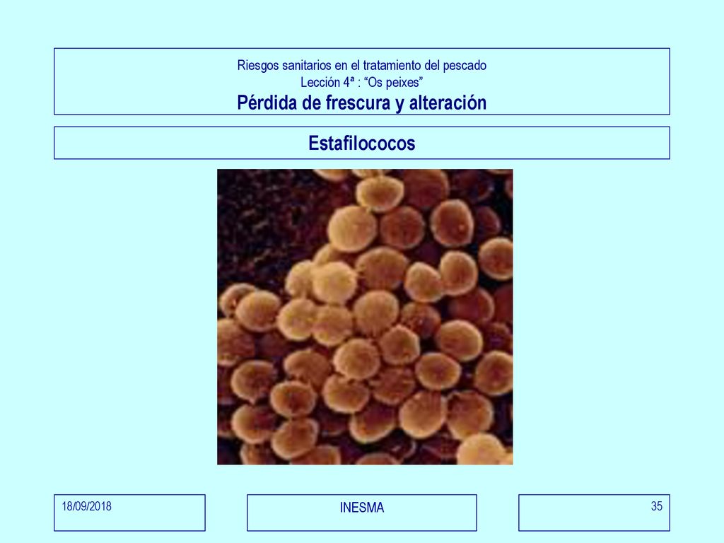 Riesgos sanitarios en el tratamiento del pescado Lección 4ª : Os peixes Pérdida de frescura y alteración