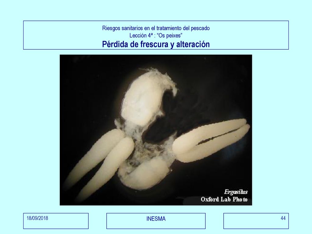 Riesgos sanitarios en el tratamiento del pescado Lección 4ª : Os peixes Pérdida de frescura y alteración