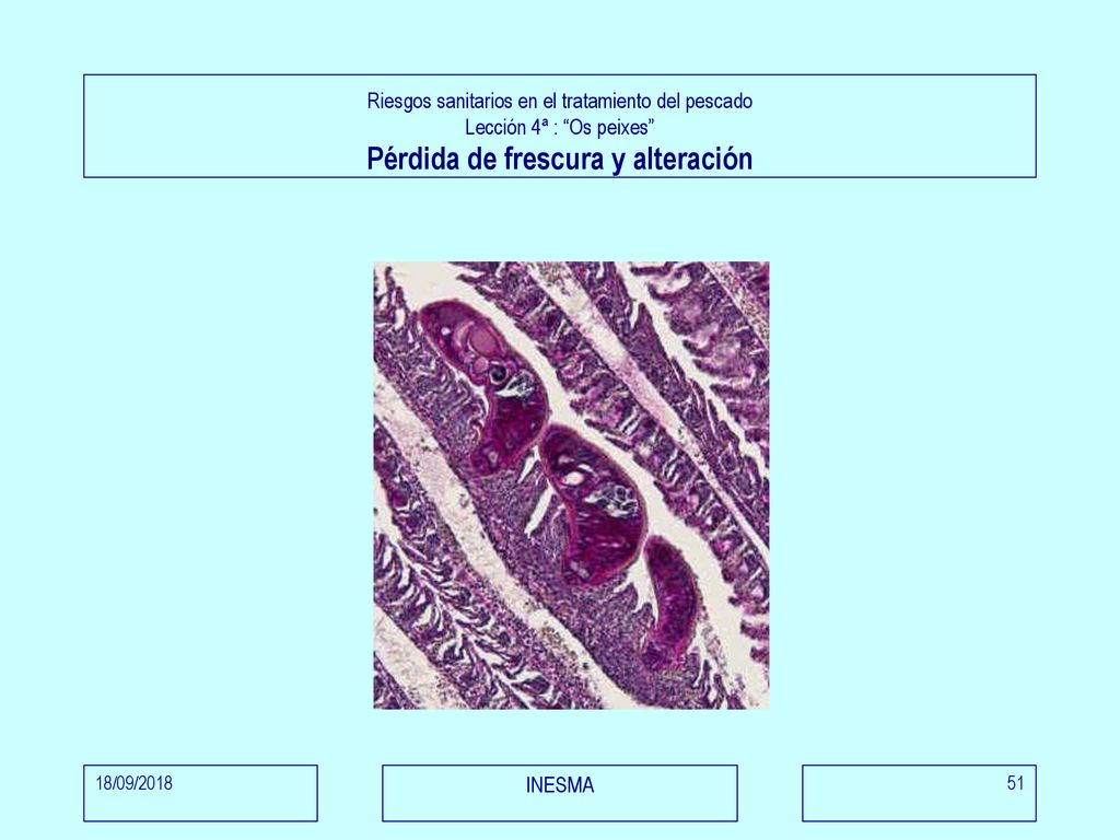 Riesgos sanitarios en el tratamiento del pescado Lección 4ª : Os peixes Pérdida de frescura y alteración