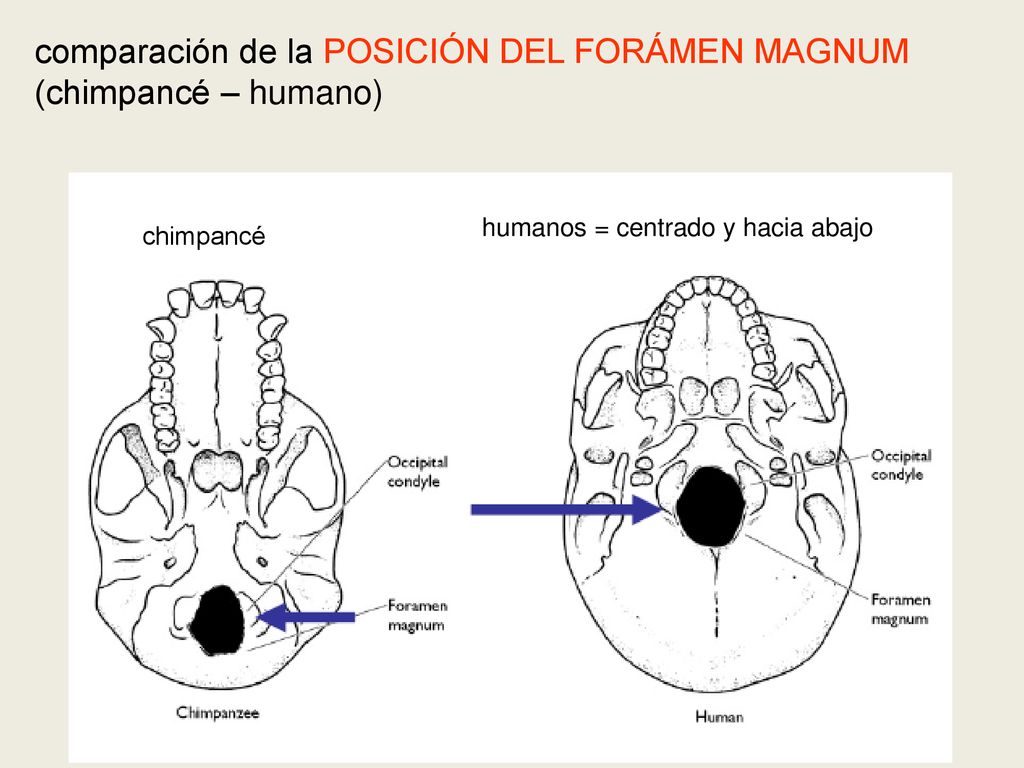 comparación de la POSICIÓN DEL FORÁMEN MAGNUM (chimpancé – humano)