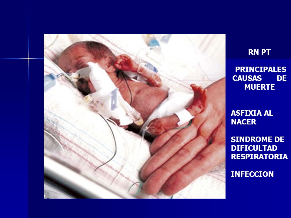 RN PT PRINCIPALES. CAUSAS DE MUERTE. ASFIXIA AL NACER. SINDROME DE DIFICULTAD RESPIRATORIA.