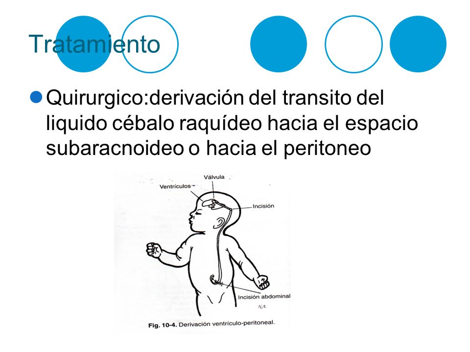 Tratamiento Quirurgico:derivación del transito del liquido cébalo raquídeo hacia el espacio subaracnoideo o hacia el peritoneo.