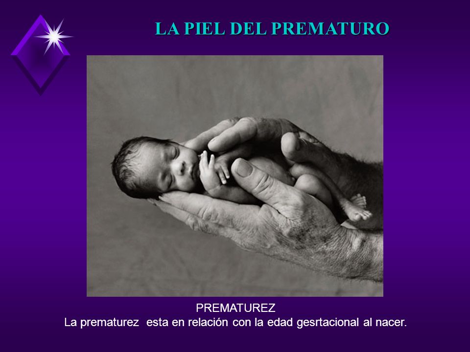 La prematurez esta en relación con la edad gesrtacional al nacer.