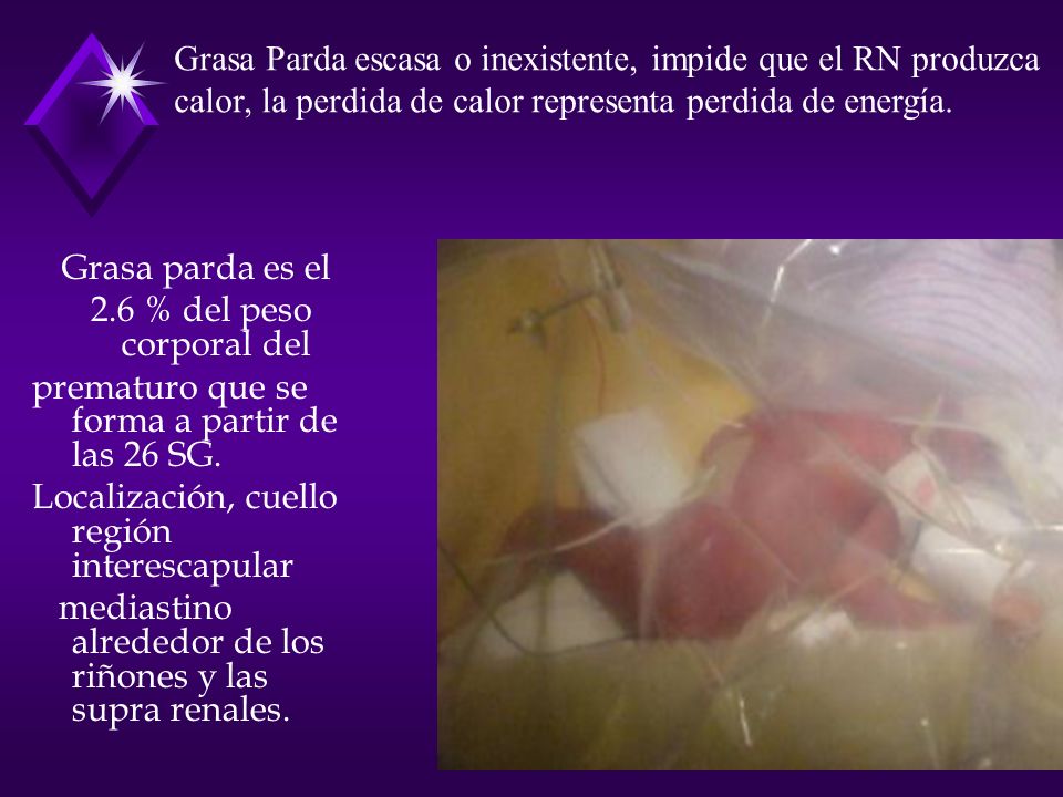 Grasa Parda escasa o inexistente, impide que el RN produzca calor, la perdida de calor representa perdida de energía.