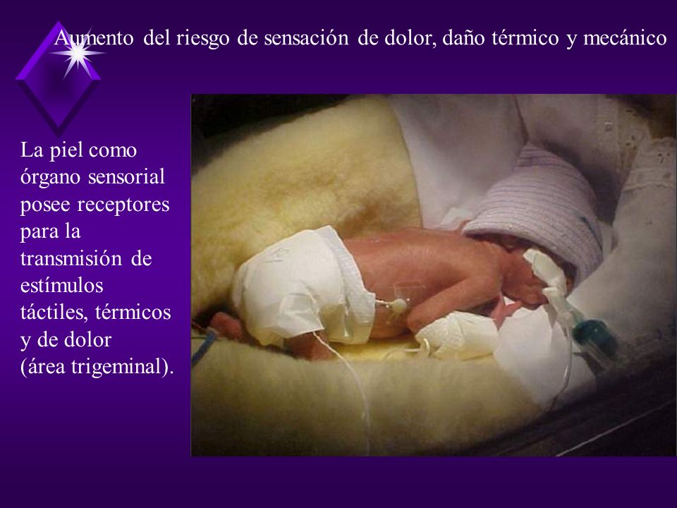 Aumento del riesgo de sensación de dolor, daño térmico y mecánico