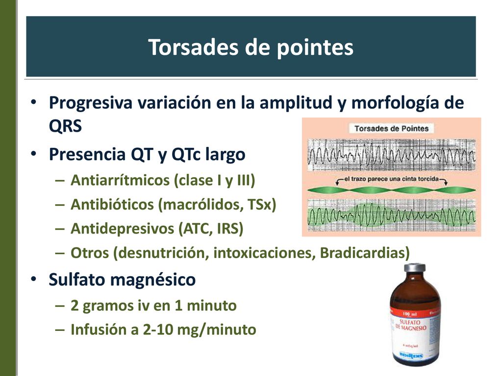 Torsades de pointes Progresiva variación en la amplitud y morfología de QRS. Presencia QT y QTc largo.