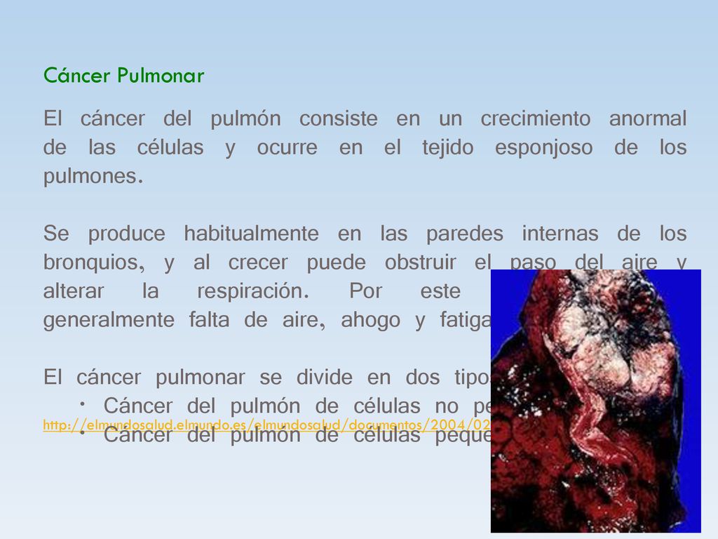 El cáncer pulmonar se divide en dos tipos principales: