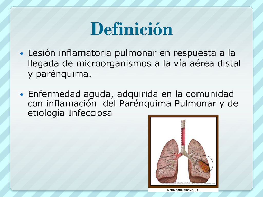 Definición Lesión inflamatoria pulmonar en respuesta a la llegada de microorganismos a la vía aérea distal y parénquima.