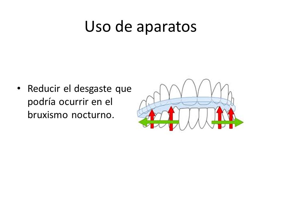 Uso de aparatos Reducir el desgaste que podría ocurrir en el bruxismo nocturno.
