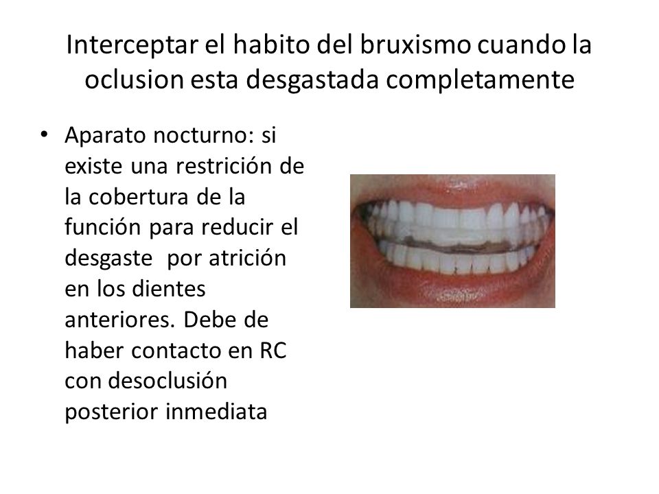 Interceptar el habito del bruxismo cuando la oclusion esta desgastada completamente