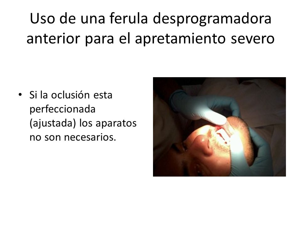 Uso de una ferula desprogramadora anterior para el apretamiento severo
