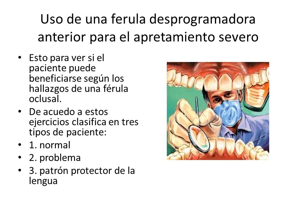 Uso de una ferula desprogramadora anterior para el apretamiento severo