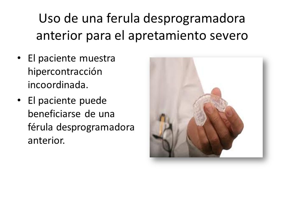 Uso de una ferula desprogramadora anterior para el apretamiento severo
