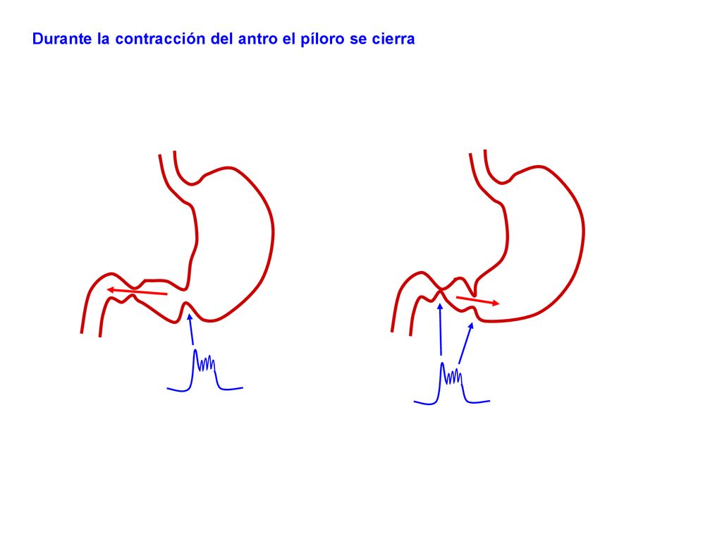 Durante la contracción del antro el píloro se cierra