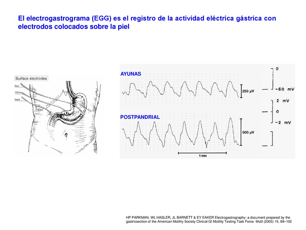 El electrogastrograma (EGG) es el registro de la actividad eléctrica gástrica con electrodos colocados sobre la piel