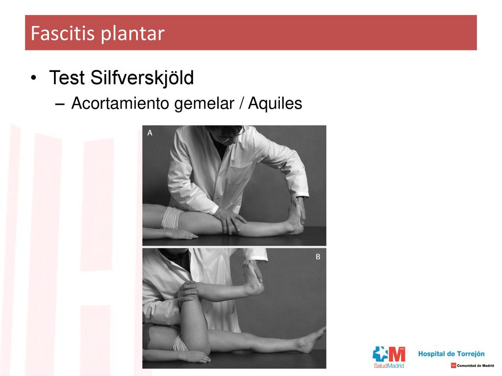 Fascitis plantar Test Silfverskjöld Acortamiento gemelar / Aquiles