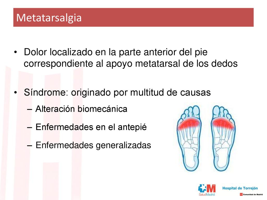 Metatarsalgia Dolor localizado en la parte anterior del pie correspondiente al apoyo metatarsal de los dedos.