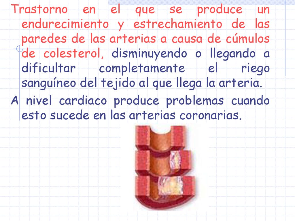 Trastorno en el que se produce un endurecimiento y estrechamiento de las paredes de las arterias a causa de cúmulos de colesterol, disminuyendo o llegando a dificultar completamente el riego sanguíneo del tejido al que llega la arteria.