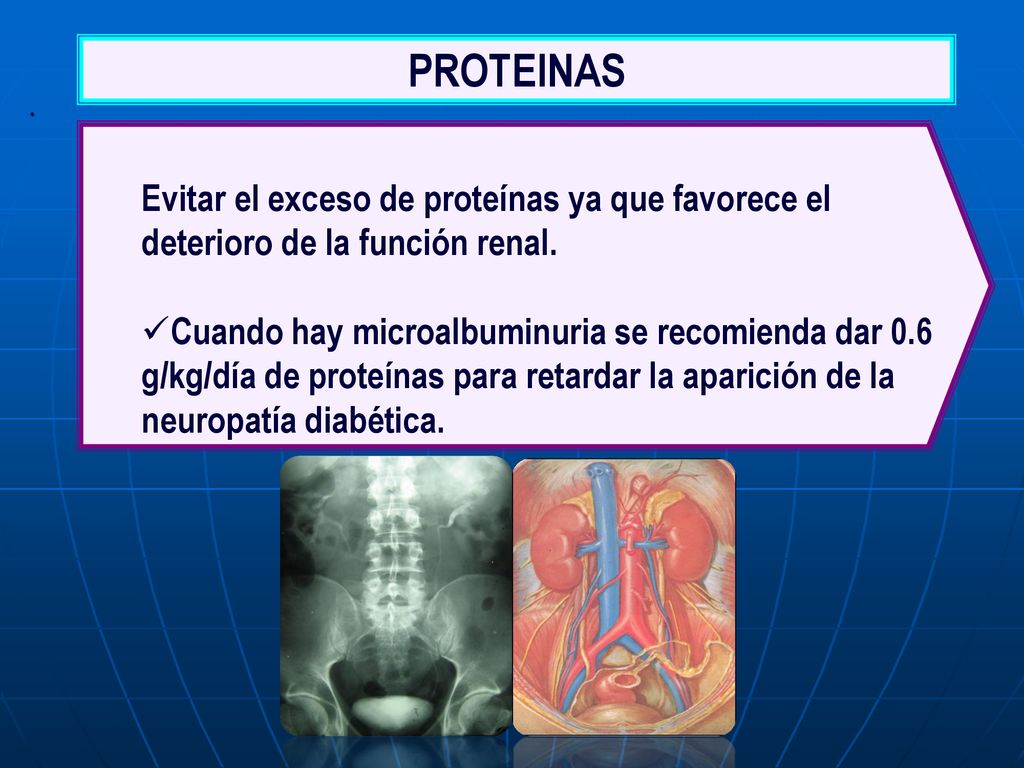 PROTEINAS . Evitar el exceso de proteínas ya que favorece el deterioro de la función renal.