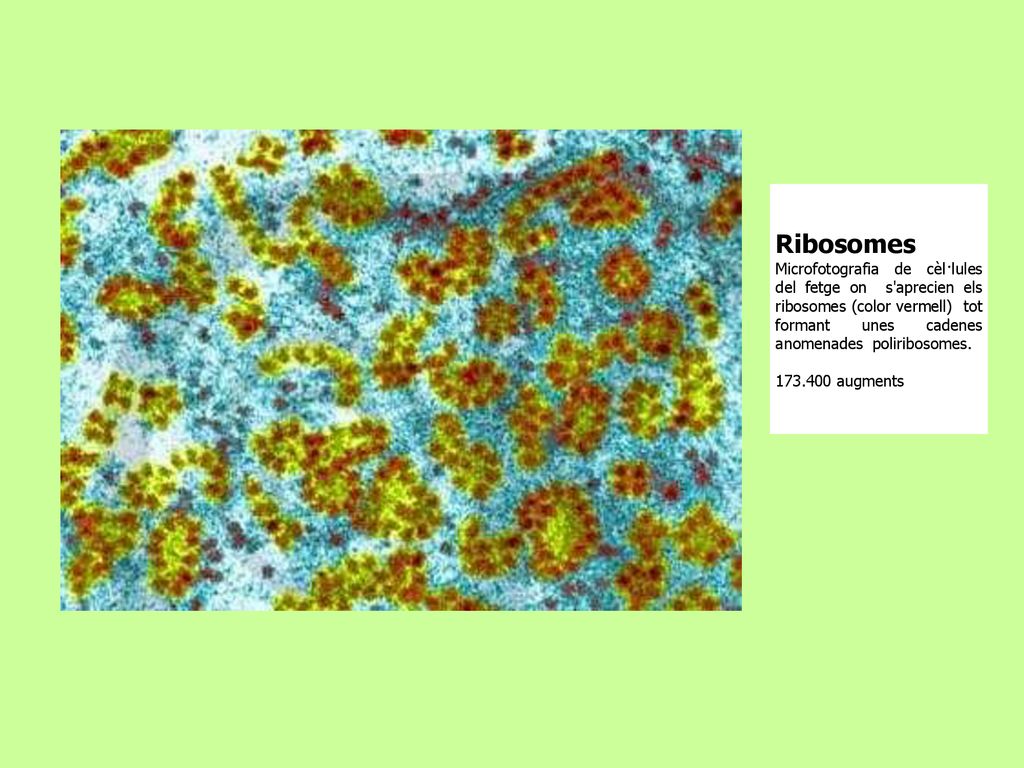 Ribosomes Microfotografia de cèl·lules del fetge on s aprecien els ribosomes (color vermell) tot formant unes cadenes anomenades poliribosomes.