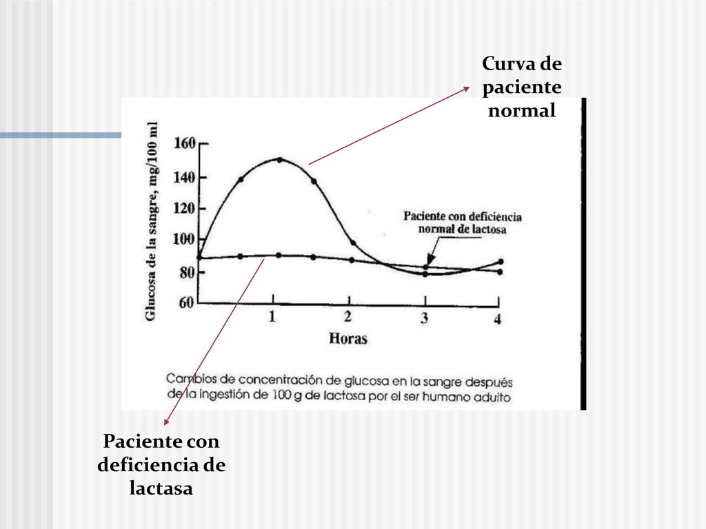 Paciente con deficiencia de lactasa Curva de paciente normal