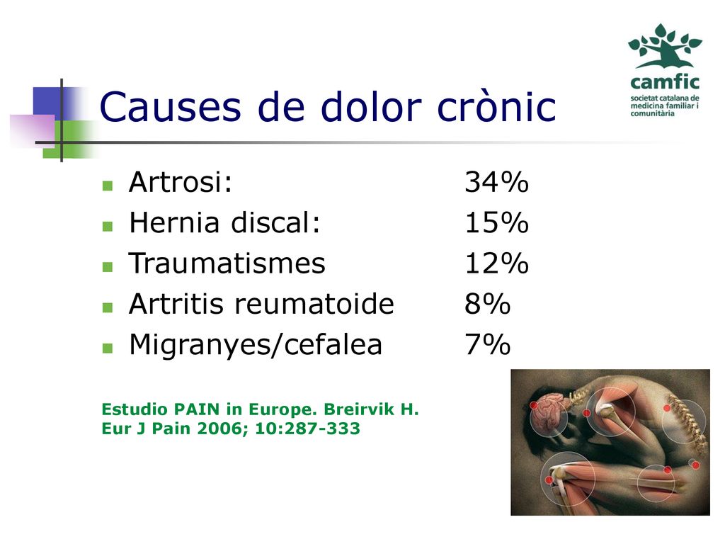 Causes de dolor crònic Dolor crónico: Prevalencia Artrosi: 34%