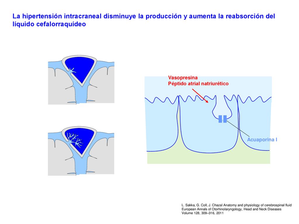 La hipertensión intracraneal disminuye la producción y aumenta la reabsorción del líquido cefalorraquídeo
