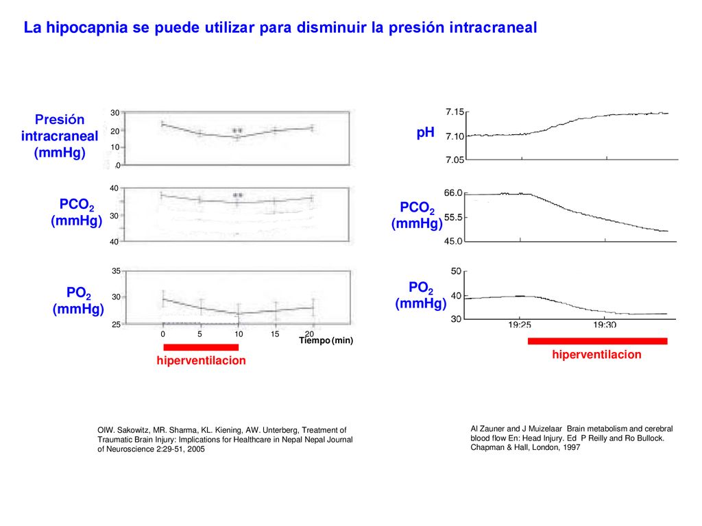 La hipocapnia se puede utilizar para disminuir la presión intracraneal