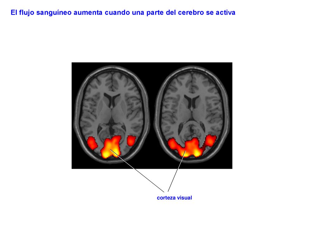 El flujo sanguíneo aumenta cuando una parte del cerebro se activa