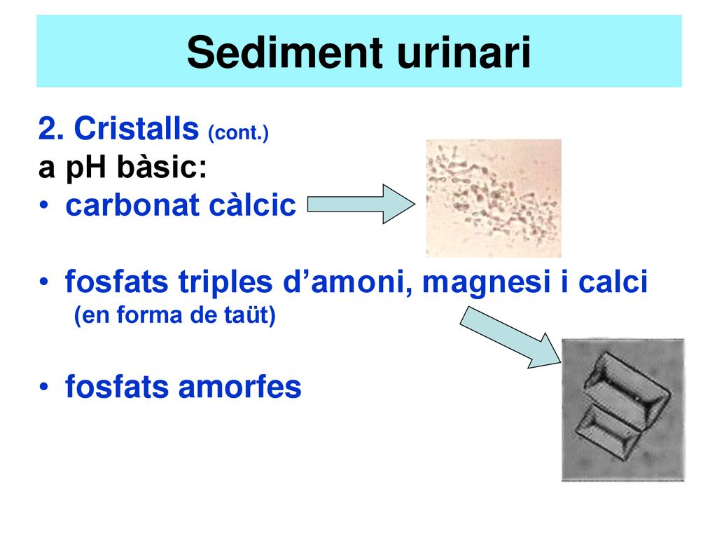 Sediment urinari 2. Cristalls (cont.) a pH bàsic: carbonat càlcic
