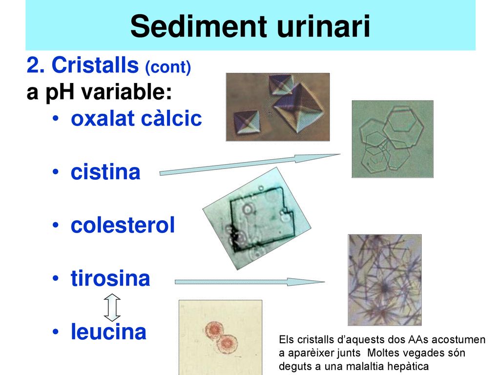 Sediment urinari 2. Cristalls (cont) a pH variable: oxalat càlcic